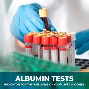 ALBUMIN TEST - INDICATOR FOR THE WELLNESS OF YOUR LIVER & KIDNEY…